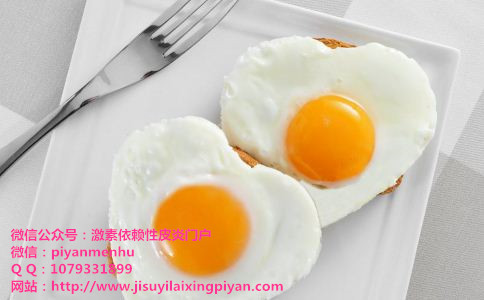 激素皮炎患者可以吃鸡蛋吗？治疗激素依赖性皮炎有哪些饮食禁忌？