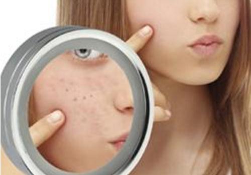 激素脸脱皮结痂能用香油保湿吗？激素脸用什么护肤品保湿？